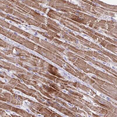 Immunohistochemistry-Paraffin: MT-ND4 Antibody [NBP2-47365] - Staining of human heart muscle shows moderate cytoplasmic positivity in myocytes.