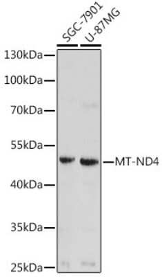 Western Blot: MT-ND4 Antibody [NBP2-93530] - Analysis of extracts of various cell lines, using MT-ND4 at 1:1000 dilution.Secondary antibody: HRP Goat Anti-Rabbit IgG (H+L) at 1:10000 dilution.Lysates/proteins: 25ug per lane.Blocking buffer: 3% nonfat dry milk in TBST.Detection: ECL Basic Kit .Exposure time: 3min.