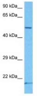 Western Blot: MT-ND4 Antibody [NBP3-10134] - Western blot analysis of MT-ND4 in Mouse Lung lysates. Antibody dilution at 1ug/ml