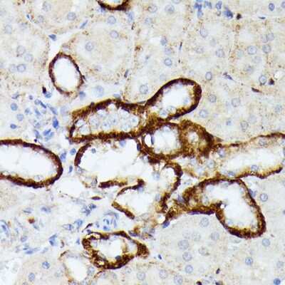 Immunohistochemistry-Paraffin: MT-ND5 Antibody [NBP3-05604] - Rat kidney using MT-ND5 antibody (NBP3-05604) at dilution of 1:100 (40x lens).