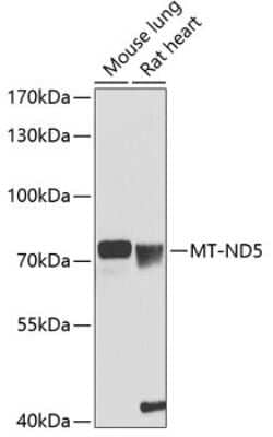 Western Blot: MT-ND5 Antibody [NBP3-05605] - Western blot analysis of extracts of various cell lines, using MT-ND5 antibody (NBP3-05605) at 1:1000 dilution. Secondary antibody: HRP Goat Anti-Rabbit IgG (H+L) at 1:10000 dilution. Lysates/proteins: 25ug per lane. Blocking buffer: 3% nonfat dry milk in TBST. Detection: ECL Basic Kit. Exposure time: 90s.