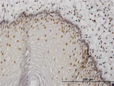 Immunohistochemistry-Paraffin: MTA1 Antibody (4D5) [H00009112-M01] - Analysis of monoclonal antibody to MTA1 on formalin-fixed paraffin-embedded human esophagus. Antibody concentration 1.2 ug/ml.