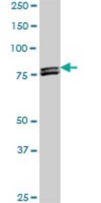 Western Blot: MTA1 Antibody (4D5) [H00009112-M01] - MTA1 monoclonal antibody (M01), clone 4D5. Analysis of MTA1 expression in PC-12.