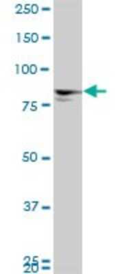 Western Blot: MTA1 Antibody (4D5) [H00009112-M01] - MTA1 monoclonal antibody (M01), clone 4D5. Analysis of MTA1 expression in IMR-32.