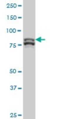 Western Blot: MTA1 Antibody (4D5) [H00009112-M01] - MTA1 monoclonal antibody (M01), clone 4D5 Analysis of MTA1 expression in Hela S3 NE.