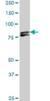 Western Blot: MTA1 Antibody (4D5) [H00009112-M01] - MTA1 monoclonal antibody (M01), clone 4D5. Analysis of MTA1 expression in NIH/3T3.