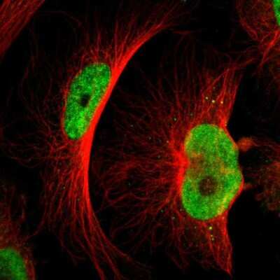 Immunocytochemistry/Immunofluorescence: MTA1 Antibody [NBP1-89467] - Immunofluorescent staining of human cell line U-251 MG shows localization to nucleoplasm.