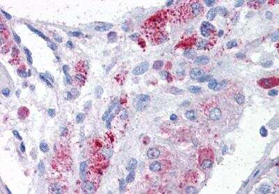 Immunohistochemistry-Paraffin: MTA1 Antibody [NB100-823] - Staining of paraffin embedded Human Testis. Steamed antigen retrieval with citrate buffer pH 6, AP-staining.