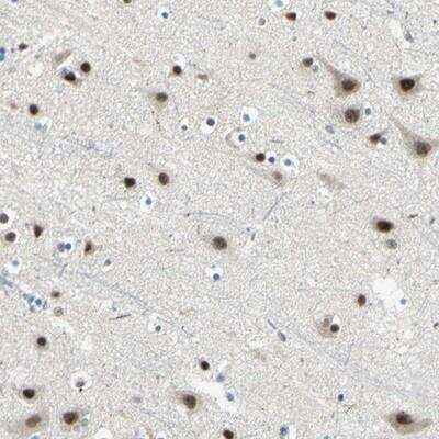 Immunohistochemistry-Paraffin: MTA1 Antibody [NBP1-89467] - Staining of human cerebral cortex shows strong nuclear positivity in neuronal cells.