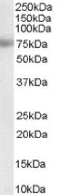 Western Blot: MTA1 Antibody [NB100-823] - Staining of Human Placenta lysate (RIPA buffer, 35 ug total protein per lane). Primary incubated for 1 hour. Detected by chemiluminescence.