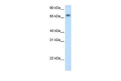 Western Blot: MTA2 Antibody [NBP2-87850] - WB Suggested Anti-Mta2 Antibody Titration: 0.725ug/ml. Positive Control: SP2/0 cell lysate