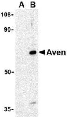 Western Blot: MTA2 Peptide [NBP1-76748PEP] - blocks the antibody activity completely in Western blot by incubating the peptide with equal volume of antibody for 30 min at 37C