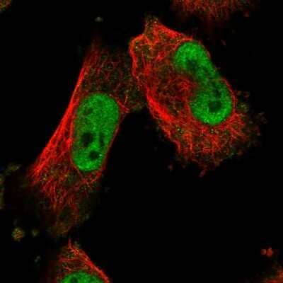 Immunocytochemistry/ Immunofluorescence MTA3 Antibody