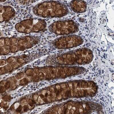 Immunohistochemistry-Paraffin MTA3 Antibody