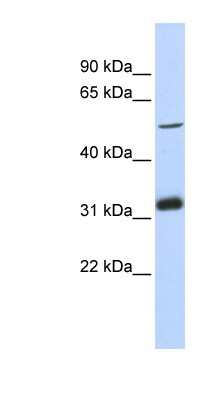 Western Blot: MTAC2D1 Antibody [NBP1-55422] - MCF-7 whole cell lysates, concentration 0.2-1 ug/ml.