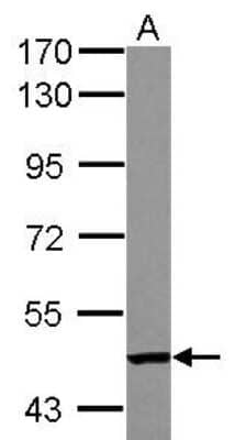 Western Blot: MTAC2D1 Antibody [NBP2-19425] - Sample (30 ug of whole cell lysate) A: A549 7. 5% SDS PAGE gel, diluted at 1:1000.