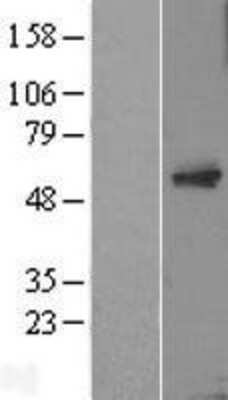 Western Blot: MTAC2D1 Overexpression Lysate (Adult Normal) [NBL1-16754] Left-Empty vector transfected control cell lysate (HEK293 cell lysate); Right -Over-expression Lysate for MTAC2D1.