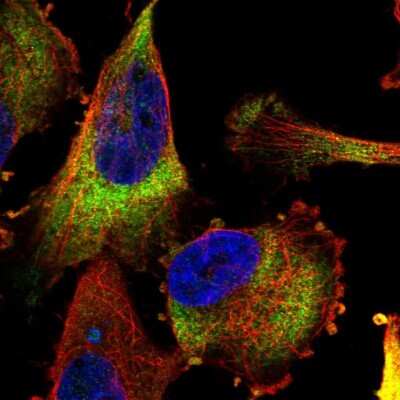 Immunocytochemistry/Immunofluorescence: MTAP Antibody [NBP2-56796] - Staining of human cell line U-251 MG shows localization to cytosol.