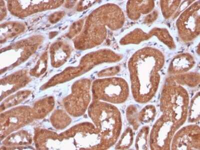 Immunohistochemistry-Paraffin: MTAP Antibody (MTAP/3137R) - Azide and BSA Free [NBP3-08965] - Formalin-fixed, paraffin-embedded human Kidney stained with MTAP Recombinant Rabbit Monoclonal Antibody (MTAP/3137R).