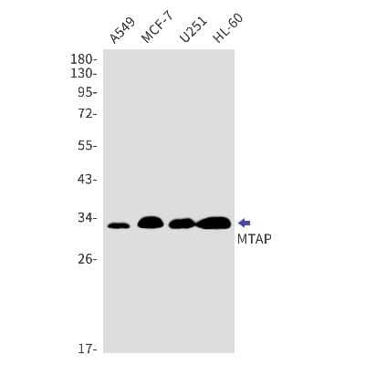 Western Blot: MTAP Antibody (S07-5A0) [NBP3-14956] - Western blot detection of MTAP in A549, MCF-7, U251, HL-60 cell lysates using MTAP Rabbit mAb (1:1000 diluted). Predicted band size: 31kDa. Observed band size: 31kDa.