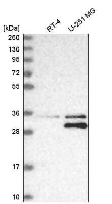 Western Blot: MTAP Antibody [NBP2-56796] - Analysis in human cell line RT-4 and human cell line U-251 MG.