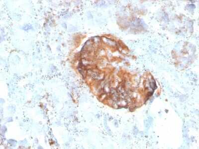 Immunohistochemistry-Paraffin: MTAP Antibody (rMTAP/1813) - Azide and BSA Free [NBP3-08964] - Formalin-fixed, paraffin-embedded human Kidney stained with MTAP Recombinant Mouse Monoclonal Antibody (rMTAP/1813).