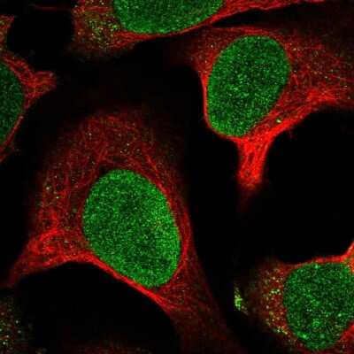Immunocytochemistry/Immunofluorescence: MTBP Antibody [NBP2-55351] - Staining of human cell line U-2 OS shows localization to nucleus.
