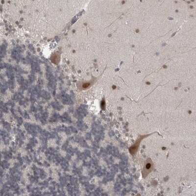 Immunohistochemistry-Paraffin MTBP Antibody - BSA Free