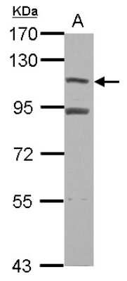 Western Blot: MTBP Antibody [NBP2-19426] - Sample (30 ug of whole cell lysate) A: K562 7. 5% SDS PAGE gel, diluted at 1:3000.