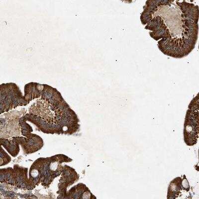 Immunohistochemistry-Paraffin: MTCH1 Antibody [NBP1-84505] - Staining of human duodenum shows cytoplasmic positivity in glandular cells.