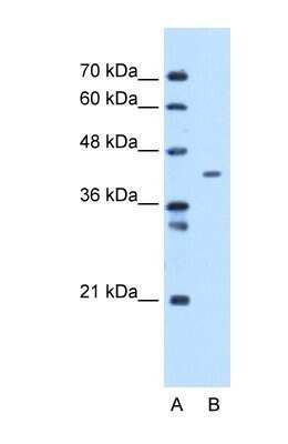 Western Blot: MTCH1 Antibody [NBP1-69285] - This Anti-MTCH1 antibody was used in Western Blot of HepG2 tissue lysate at a concentration of 1ug/ml.