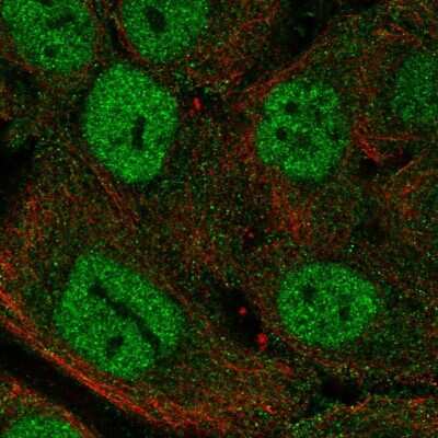 Immunocytochemistry/Immunofluorescence: MTCP1 Antibody [NBP2-58455] - Staining of human cell line HaCaT shows localization to nucleoplasm & plasma membrane.