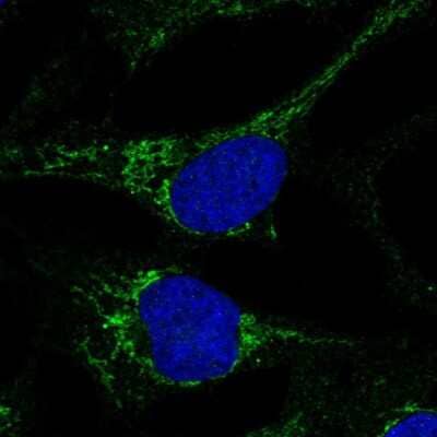 Immunocytochemistry/ Immunofluorescence MTCP1NB Antibody - BSA Free