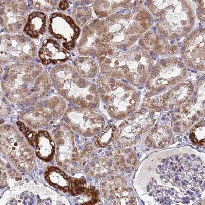 Immunohistochemistry-Paraffin MTCP1NB Antibody - BSA Free