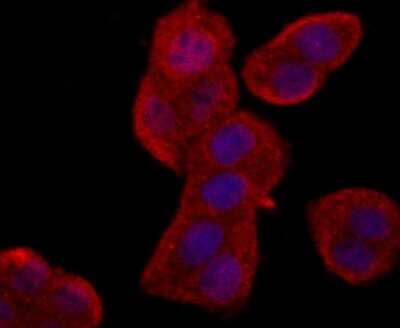 Immunocytochemistry/Immunofluorescence: MTERFD1 Antibody [NBP2-75576] - Staining MTERFD1 in Hela cells (red). The nuclear counter stain is DAPI (blue). Cells were fixed in paraformaldehyde, permeabilised with 0.25% Triton X100/PBS.