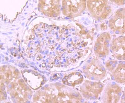 Immunohistochemistry-Paraffin: MTERFD1 Antibody [NBP2-75576] - Analysis of paraffin-embedded human kidney tissue using anti-MTERFD1 antibody. Counter stained with hematoxylin.