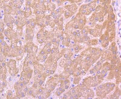 Immunohistochemistry-Paraffin: MTERFD1 Antibody [NBP2-75576] - Analysis of paraffin-embedded human liver tissue using anti-MTERFD1 antibody. Counter stained with hematoxylin.