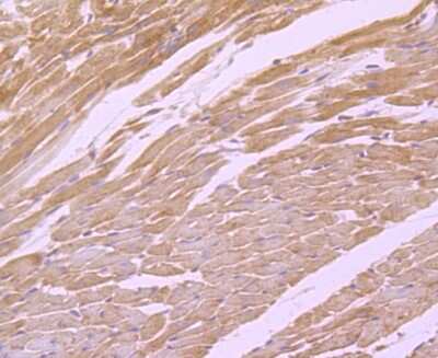 Immunohistochemistry-Paraffin: MTERFD1 Antibody [NBP2-75576] - Analysis of paraffin-embedded mouse heart tissue using anti-MTERFD1 antibody. Counter stained with hematoxylin.