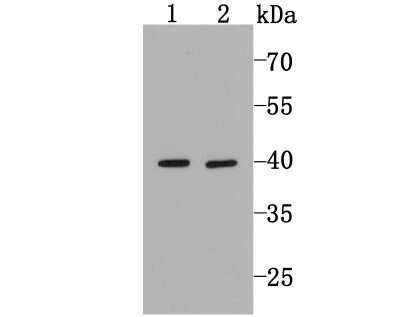 Western Blot: MTERFD1 Antibody [NBP2-75576] - Analysis of MTERFD1 on Hela (1) and HepG2 (2) cell lysates using anti-MTERFD1 antibody at 1/500 dilution.