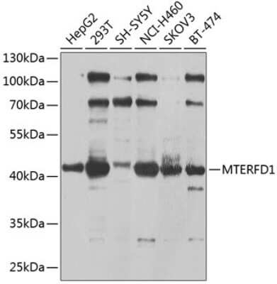 Western Blot: MTERFD1 Antibody [NBP2-93317] - Analysis of extracts of various cell lines, using MTERFD1 at 1:1000 dilution.Secondary antibody: HRP Goat Anti-Rabbit IgG (H+L) at 1:10000 dilution.Lysates/proteins: 25ug per lane.Blocking buffer: 3% nonfat dry milk in TBST.Detection: ECL Basic Kit .Exposure time: 30s.