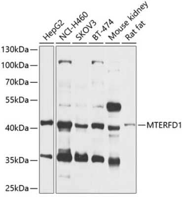 Western Blot: MTERFD1 Antibody [NBP2-95134] - Analysis of extracts of various cell lines, using MTERFD1 at 1:1000 dilution.Secondary antibody: HRP Goat Anti-Rabbit IgG (H+L) at 1:10000 dilution.Lysates/proteins: 25ug per lane.Blocking buffer: 3% nonfat dry milk in TBST.Detection: ECL Basic Kit .Exposure time: 30s.