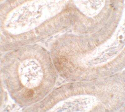 Immunohistochemistry MTERFD3 Antibody - BSA Free