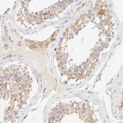 Immunohistochemistry-Paraffin: MTERFD3 Antibody [NBP1-82241] - Staining of human testis shows weak to moderate cytoplasmic positivity in cells in seminiferous ducts.