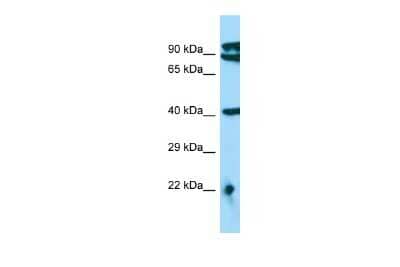 Western Blot: MTERFD3 Antibody [NBP2-83238] - WB Suggested Anti-MTERFD3 Antibody. Titration: 1.0 ug/ml. Positive Control: HepG2 Whole Cell