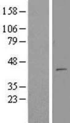 Western Blot MTERFD3 Overexpression Lysate