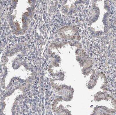 Immunohistochemistry-Paraffin: MTF1 Antibody [NBP1-86379] - Staining of human endometrium shows weak positivity in nuclear membrane in glandular cells.