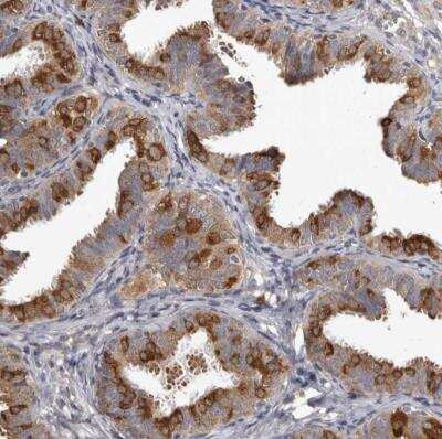 Immunohistochemistry-Paraffin: MTF1 Antibody [NBP1-86379] - Staining of human fallopian tube shows strong cytoplasmic positivity in glandular cells.