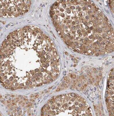 Immunohistochemistry-Paraffin: MTF1 Antibody [NBP1-86379] - Staining of human testis shows strong cytoplasmic positivity in cells in seminiferous ducts.