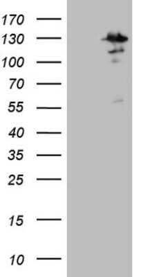 Western Blot: MTF1 Antibody (OTI2F3) - Azide and BSA Free [NBP2-72796] - Analysis of HEK293T cells were transfected with the pCMV6-ENTRY control (Left lane) or pCMV6-ENTRY MTF1.