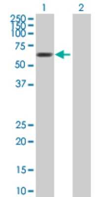 Western Blot: MTF2 Antibody [H00022823-B01P] - Analysis of MTF2 expression in transfected 293T cell line by MTF2 polyclonal antibody.  Lane 1: MTF2 transfected lysate(58.96 KDa). Lane 2: Non-transfected lysate.